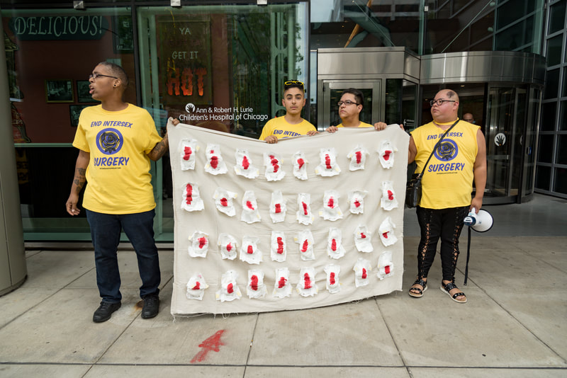 Saifa, Pidgeon, Mo, and Koomah holding an art piece by Koomah, bloody diapers representing intersex surgeries outside the front entrance to Lurie Children's Hospital of Chicago.